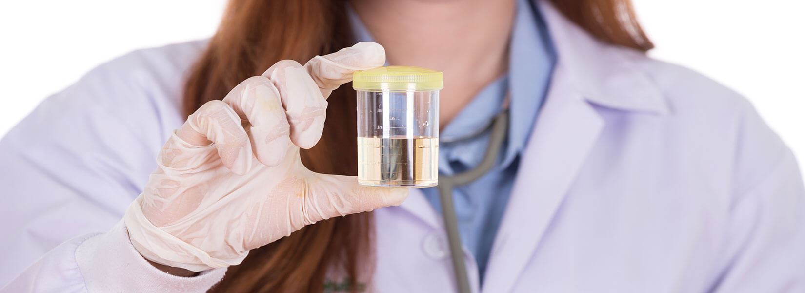 Nurse holding a urine test in her hands