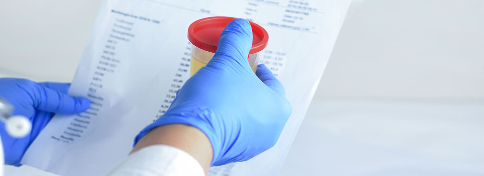 Refuse to Take a Drug Test
